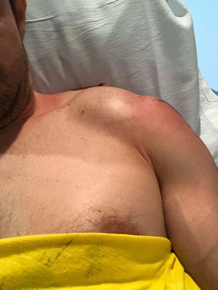 Фото Тони Майлса из больницы